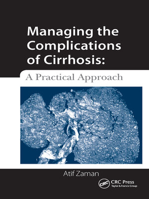 cover image of Managing the Complications of Cirrhosis